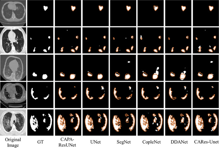 FIGURE 4