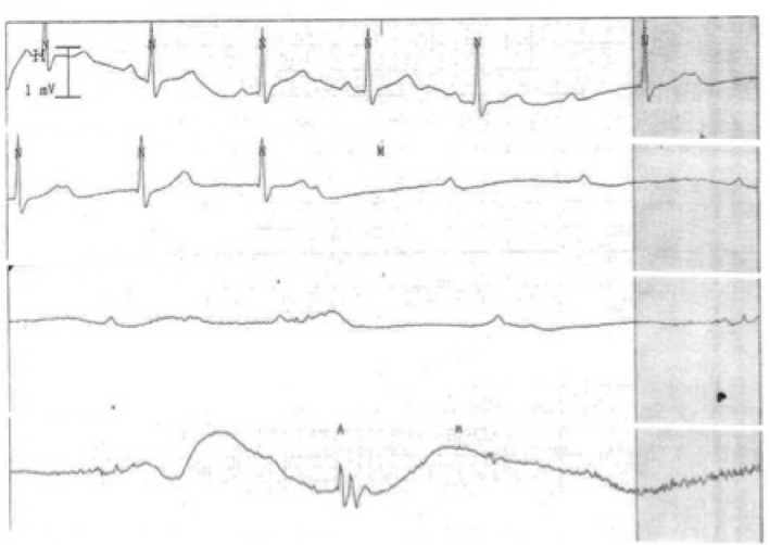 Fig. 4