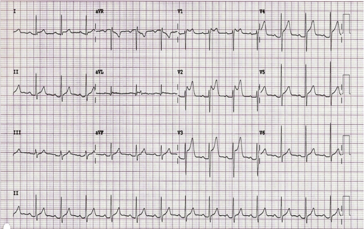 Figure 1