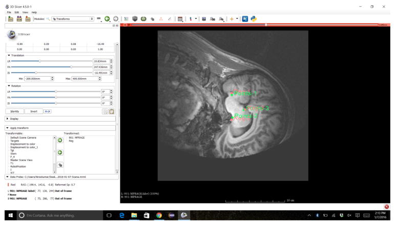 Fig. 12