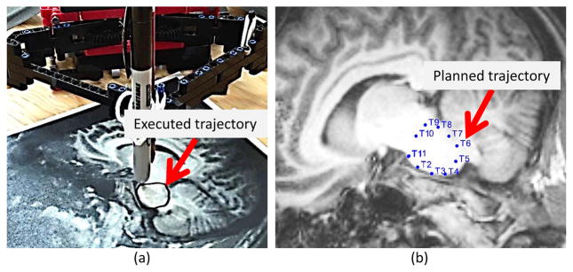 Fig. 13