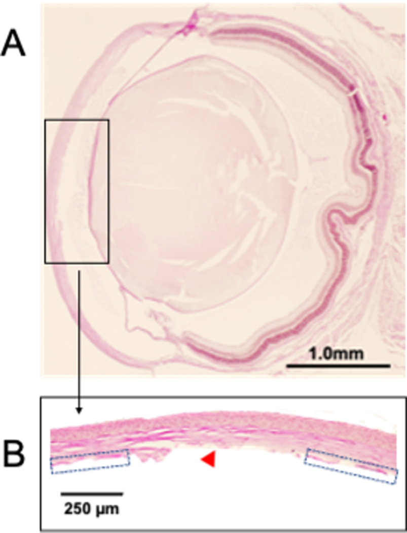 An external file that holds a picture, illustration, etc.
Object name is nihms-1852219-f0004.jpg