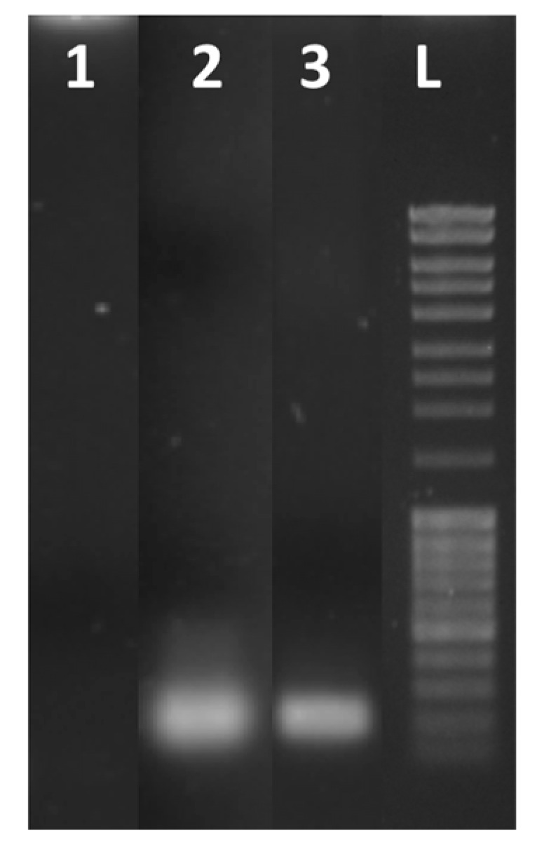 An external file that holds a picture, illustration, etc.
Object name is biosensors-13-00544-g008.jpg