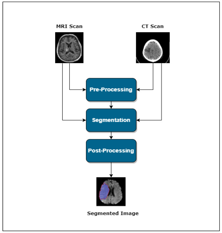 An external file that holds a picture, illustration, etc.
Object name is bioengineering-11-00086-g001.jpg