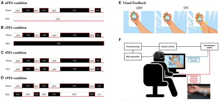 An external file that holds a picture, illustration, etc.
Object name is fnins-18-1373589-g0001.jpg