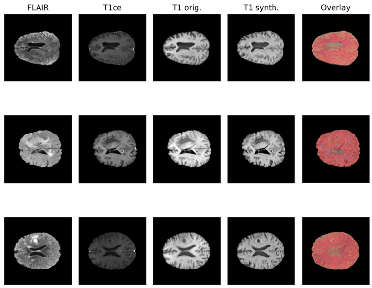 An external file that holds a picture, illustration, etc.
Object name is biomedicines-12-01878-g001.jpg