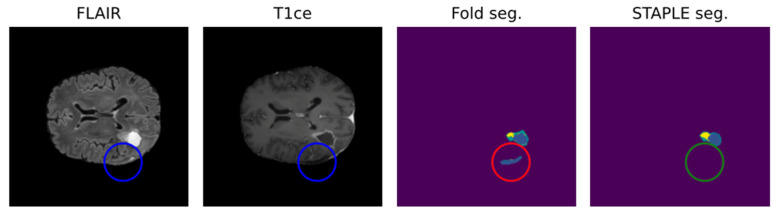 An external file that holds a picture, illustration, etc.
Object name is biomedicines-12-01878-g002.jpg