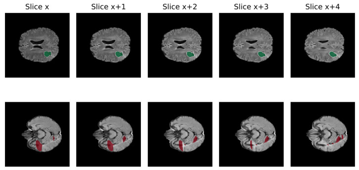 An external file that holds a picture, illustration, etc.
Object name is biomedicines-12-01878-g003.jpg