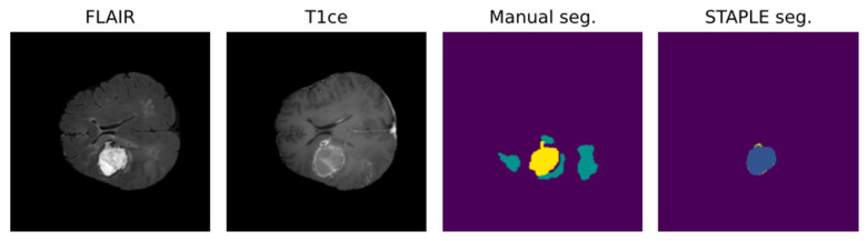 An external file that holds a picture, illustration, etc.
Object name is biomedicines-12-01878-g004.jpg