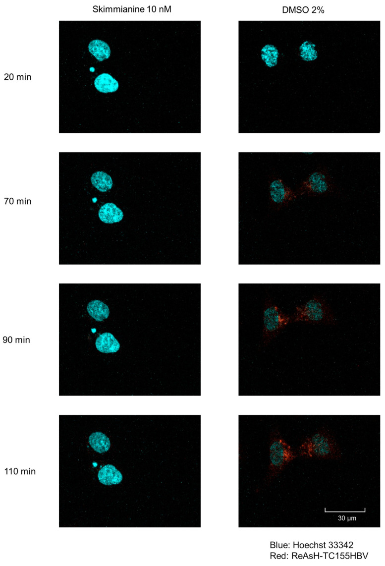 An external file that holds a picture, illustration, etc.
Object name is viruses-16-01346-g007.jpg