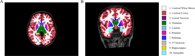 An external file that holds a picture, illustration, etc.
Object name is 13052_2024_1764_Fig1_HTML.jpg