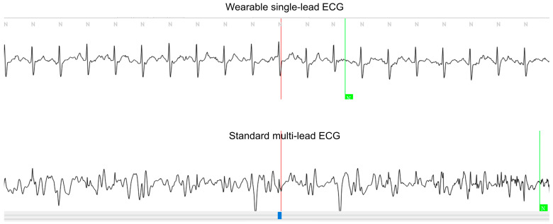 An external file that holds a picture, illustration, etc.
Object name is sensors-24-06394-g004.jpg