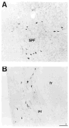 Fig. 17