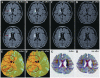 Figure 13