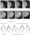 Fig. 12