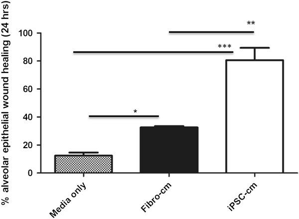 An external file that holds a picture, illustration, etc.
Object name is 13287_2014_435_Fig2_HTML.jpg