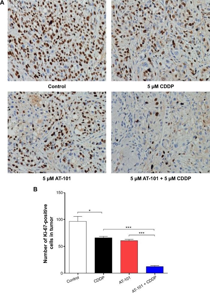 An external file that holds a picture, illustration, etc.
Object name is dddt-9-2887Fig13.jpg