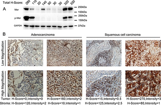 An external file that holds a picture, illustration, etc.
Object name is oncotarget-06-9206-g002.jpg