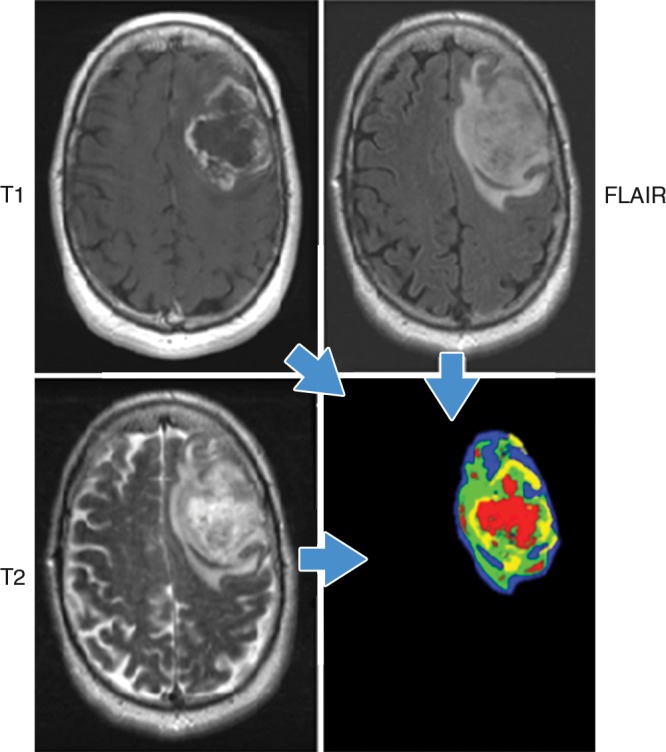 An external file that holds a picture, illustration, etc.
Object name is radiol.2015151169.fig2.jpg