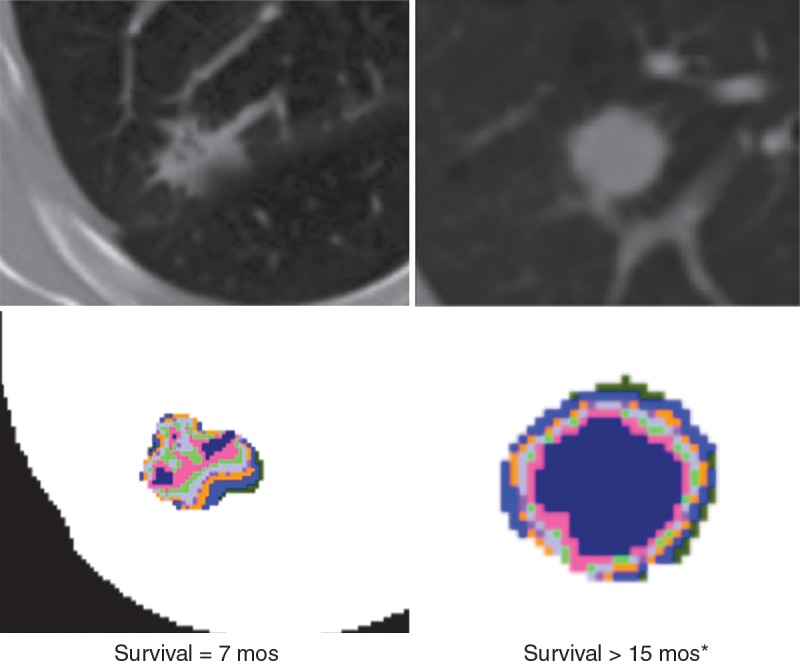 An external file that holds a picture, illustration, etc.
Object name is radiol.2015151169.fig5.jpg