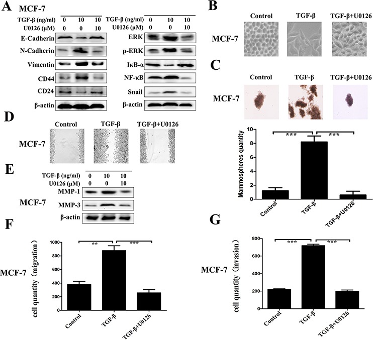 An external file that holds a picture, illustration, etc.
Object name is oncotarget-06-40907-g005.jpg