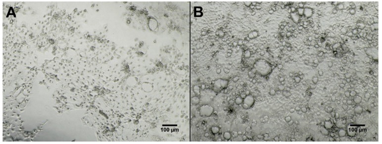 An external file that holds a picture, illustration, etc.
Object name is metabolites-06-00002-g007.jpg