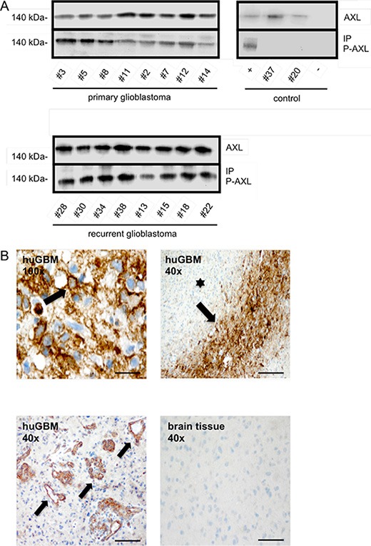 An external file that holds a picture, illustration, etc.
Object name is oncotarget-07-09876-g006.jpg