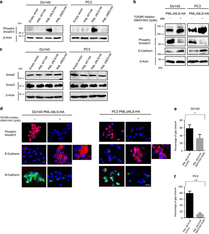 An external file that holds a picture, illustration, etc.
Object name is onc2015409f5.jpg