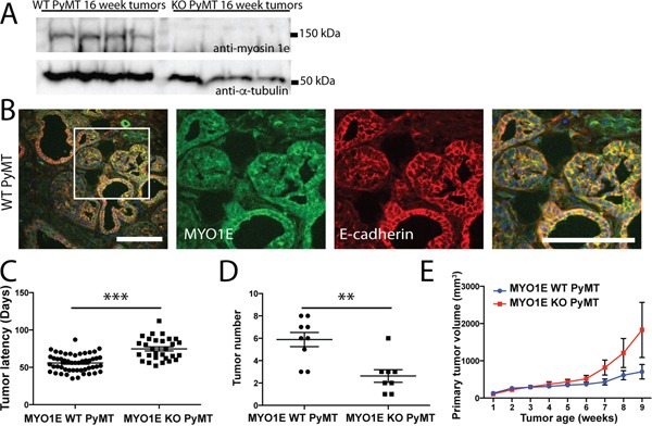 An external file that holds a picture, illustration, etc.
Object name is oncotarget-07-46419-g002.jpg