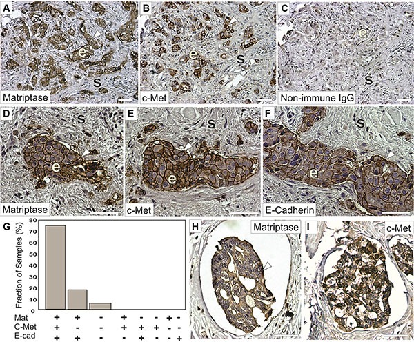 An external file that holds a picture, illustration, etc.
Object name is oncotarget-07-58162-g001.jpg