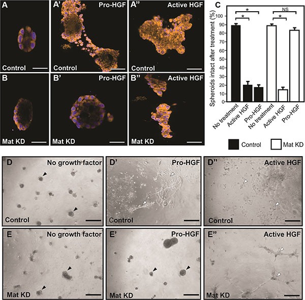 An external file that holds a picture, illustration, etc.
Object name is oncotarget-07-58162-g004.jpg