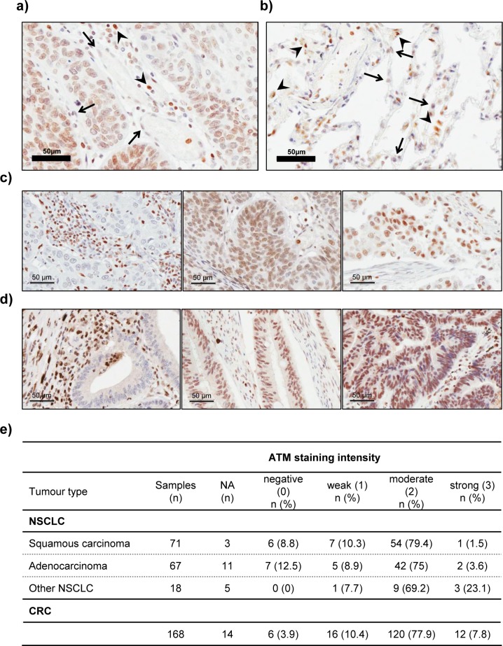 An external file that holds a picture, illustration, etc.
Object name is oncotarget-07-60807-g007.jpg