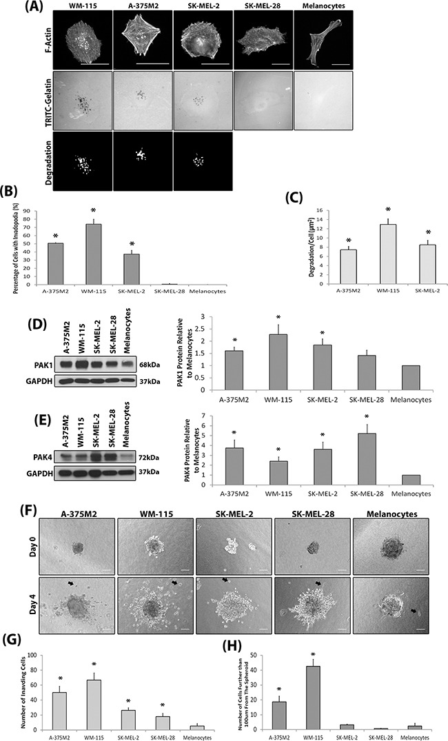 An external file that holds a picture, illustration, etc.
Object name is oncotarget-07-70881-g001.jpg