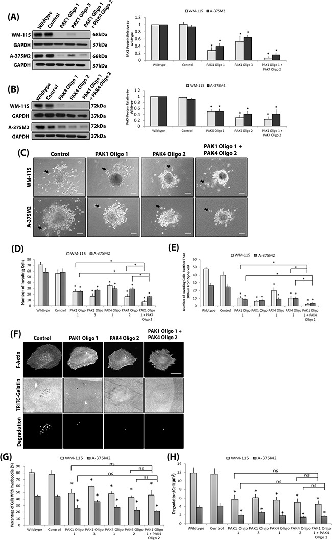 An external file that holds a picture, illustration, etc.
Object name is oncotarget-07-70881-g003.jpg