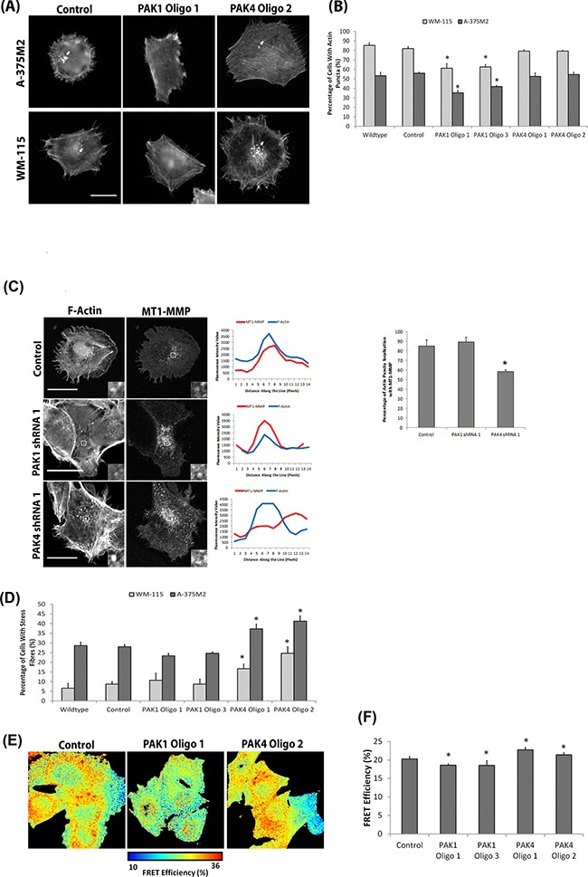 An external file that holds a picture, illustration, etc.
Object name is oncotarget-07-70881-g006.jpg