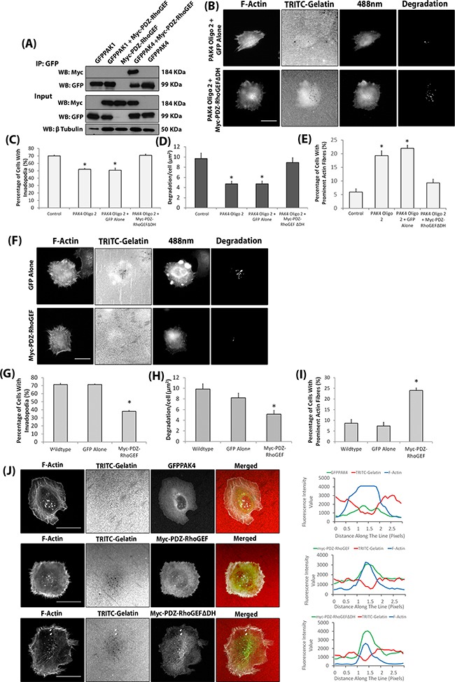 An external file that holds a picture, illustration, etc.
Object name is oncotarget-07-70881-g007.jpg