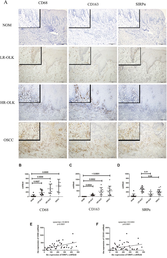 An external file that holds a picture, illustration, etc.
Object name is oncotarget-07-81305-g001.jpg