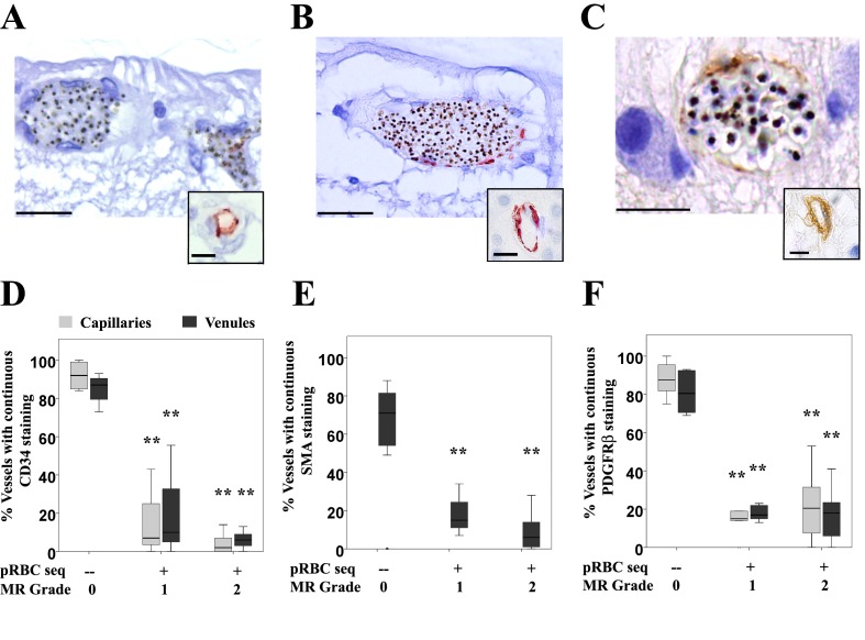 An external file that holds a picture, illustration, etc.
Object name is elife-32208-fig4.jpg