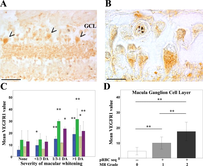 An external file that holds a picture, illustration, etc.
Object name is elife-32208-fig6.jpg