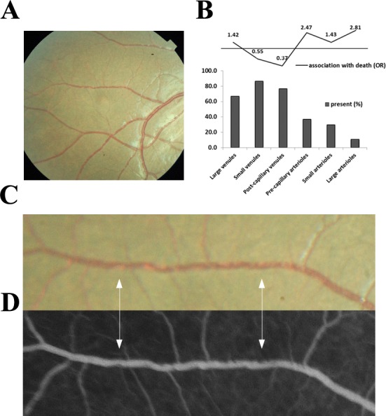 An external file that holds a picture, illustration, etc.
Object name is elife-32208-fig9.jpg