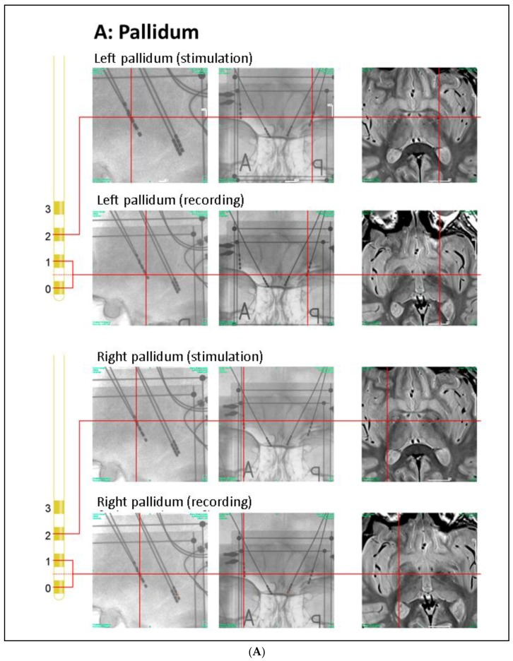 An external file that holds a picture, illustration, etc.
Object name is brainsci-08-00117-g001a.jpg