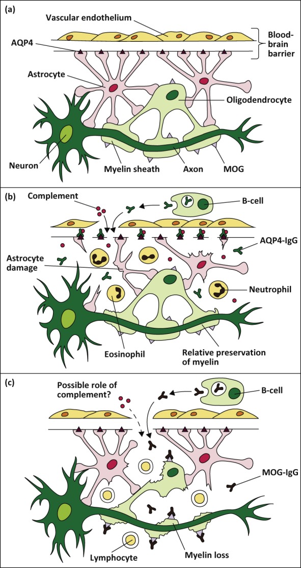 An external file that holds a picture, illustration, etc.
Object name is clinmed-19-2-169fig1.jpg