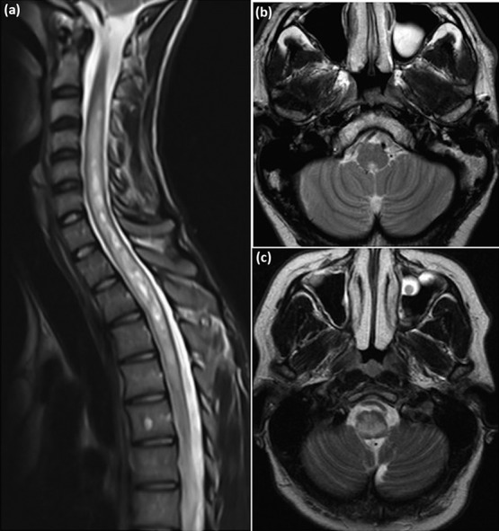 An external file that holds a picture, illustration, etc.
Object name is clinmed-19-2-169fig2.jpg