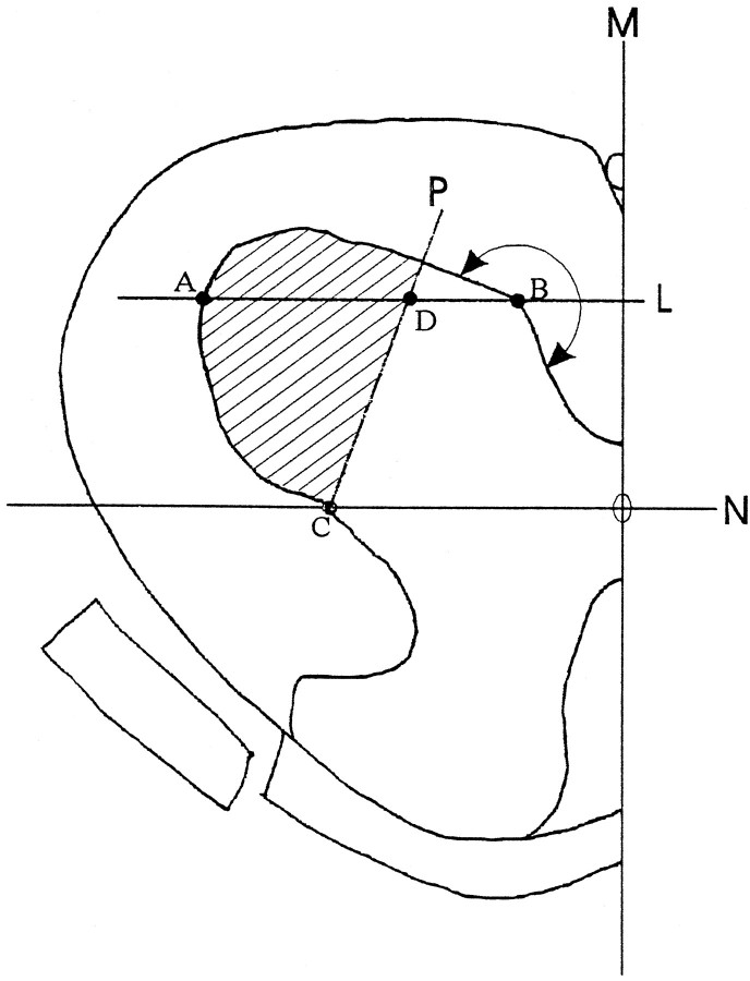 An external file that holds a picture, illustration, etc.
Object name is ns0981974001.jpg