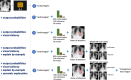 Different modalities for model interpretation. For example, an artificial intelligence (AI) system that predicts the condition from a patient s chest radiograph is shown. From top to bottom, interpretability information is added to the decision: (1) no interpretability information, (2) added output probabilities, (3) added visual saliency information describing areas of the image driving the prediction, (4) added matched real cases used during training of the AI solution influencing the prediction (ie, influential functions), and (5) added computer-generated semantic explanation.