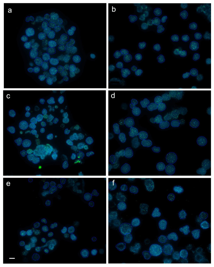 An external file that holds a picture, illustration, etc.
Object name is genes-11-00786-g001.jpg