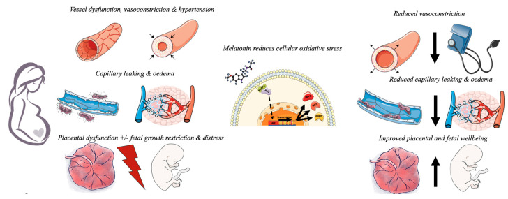 An external file that holds a picture, illustration, etc.
Object name is antioxidants-10-00376-g001.jpg