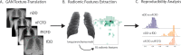 Radiomic feature (RF) reproducibility analysis pipeline. A, A cycle-GAN was first trained to translate textures between manufacturers: Philips DigitalDiagnost (DD) and Siemens Fluorospot Compact FD (FCFD). B, Following texture translation, 92 RFs were extracted from lung parenchyma for each native and fake chest radiograph of an independent testing dataset. C, The intermanufacturer RF variability was compared between pairs of native and translated chest radiographs in this independent dataset computing the concordance correlation coefficient for each RF. fDD = fake DD image, fFCFD = fake FCFD image, GAN = generative adversarial network, nDD = native DD image, nFCFD = native FCFD image.