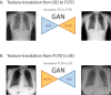 GAN model. A, An nDD is fed into a generator (GDDtoFCFD), which translates its texture to match the FCFD type, producing an fFCFD image, based on the discriminator feedback (DFCFD). B, The inverse translation is similarly performed on the basis of a second generator and discriminator pair (GFCFDtoDD and DDD, respectively). The two discriminators (DFCFD and DDD) are trained to identify native and fake images produced by their corresponding generators (GDDtoFCFD and GFCFDtoDD, respectively), providing quality feedback concerning the counterfeit images to their corresponding generator. The cycle-GAN network architecture is similar to the one used by Zhu et al (15), except for image input and output shape (here, 512   512 pixels). DD = Philips DigitalDiagonost, DDD = DD discriminator, DFCFD = FCFD discriminator, FCFD = Siemens Fluorospot Compact FD, fDD = fake DD image, fFCFD = fake FCFD image, GAN = generative adversarial network, GDDtoFCFD = generator translating DD to FCFD, GFCFDtoDD = generator translating FCFD to DD, nDD = native DD image, nFCFD = native FCFD image.