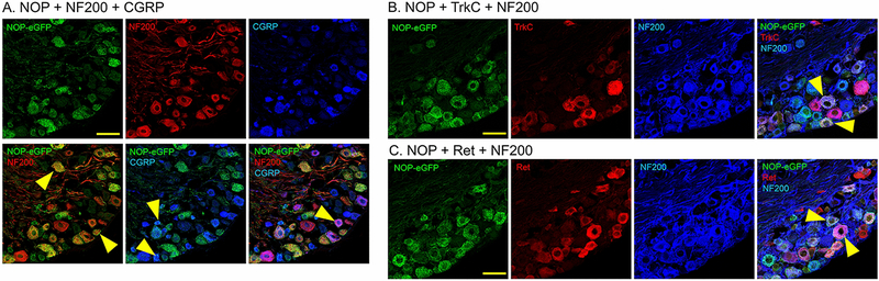 An external file that holds a picture, illustration, etc.
Object name is nihms-1719686-f0004.jpg